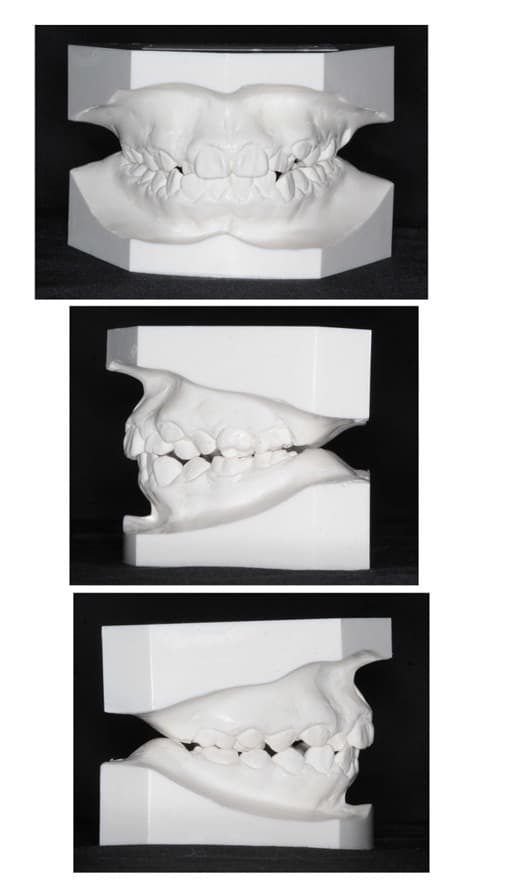 Modelos de estudio dental